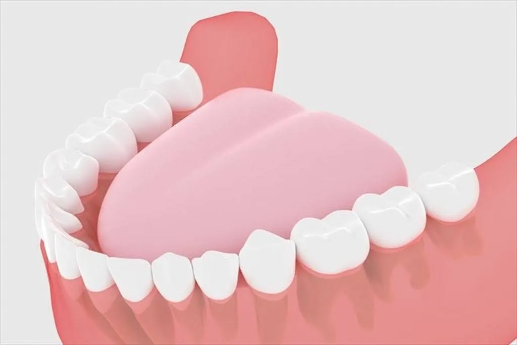 親知らずが真っ直ぐに生えている口腔内